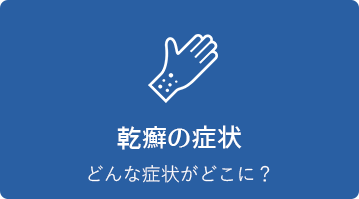 乾癬の症状
