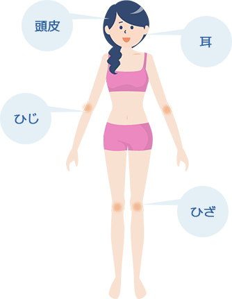 症状の出やすい場所
